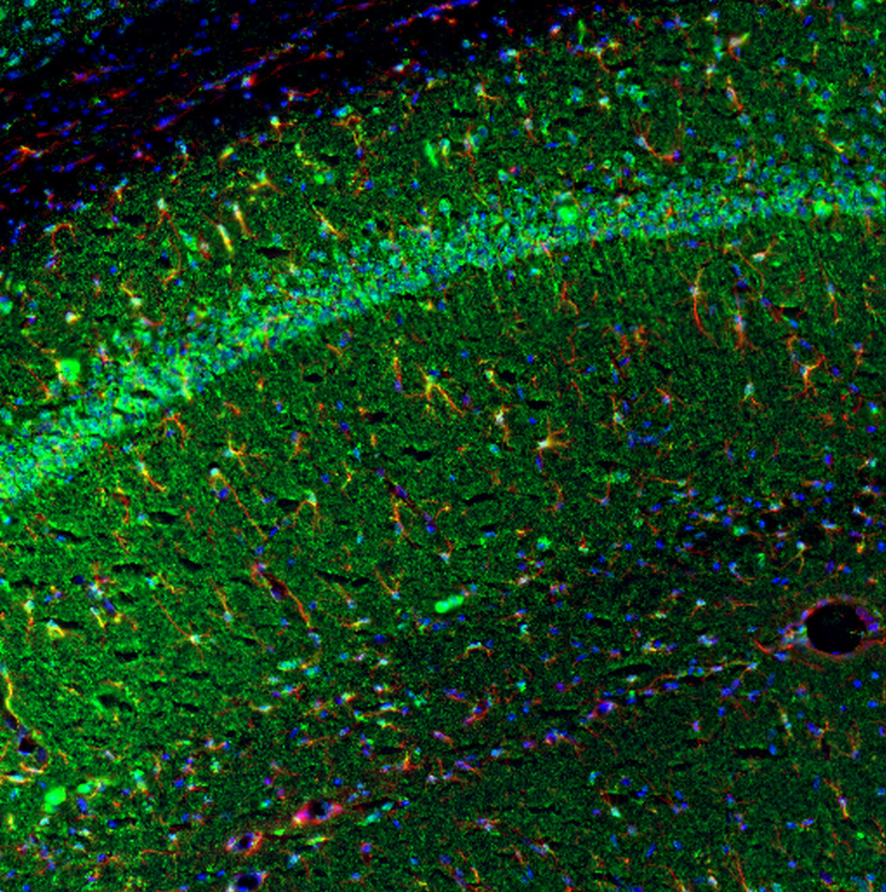 This antibody stained colchicine injected mouse brain (hippocampus CA1 region) tissue. The primary antibody was incubated at 1.0 ug/ml overnight at 4˚C. This was followed by a peroxidase conjugated secondary antibody and then a fluorescein Tyramide Signal Amplification (TSA) reagent. Optimal concentrations and conditions may vary.