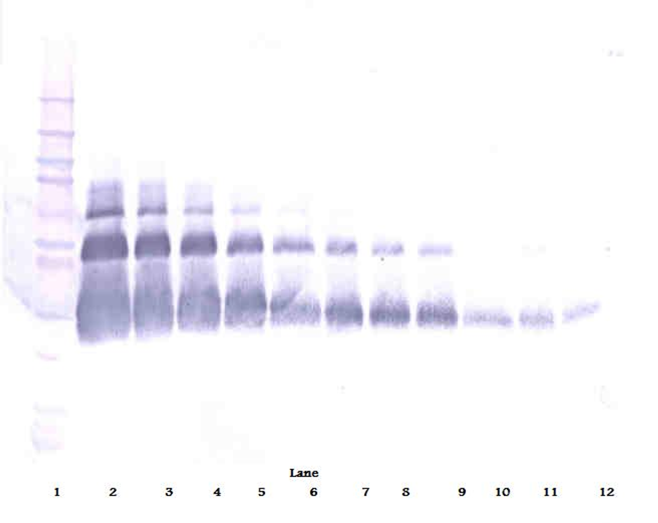 To detect hVEGF by Western Blot analysis this antibody can be used at a concentration of 0.1 - 0.2 ug/ml. Used in conjunction with compatible secondary reagents the detection limit for recombinant hVEGF is 1.5 - 3.0 ng/lane, under either reducing or non-reducing conditions.