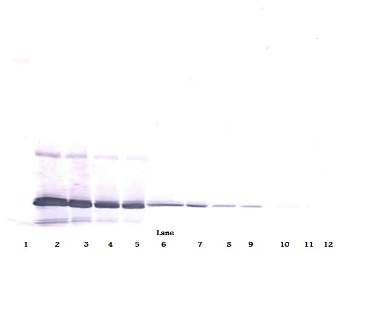 To detect hIL-11 by Western Blot analysis this antibody can be used at a concentration of 1.0-2.0 ug/ml. Used in conjunction with compatible secondary reagents the detection limit for recombinant hIL-11 is 0.25-0.50 ng/lane, under non-reducing conditions.