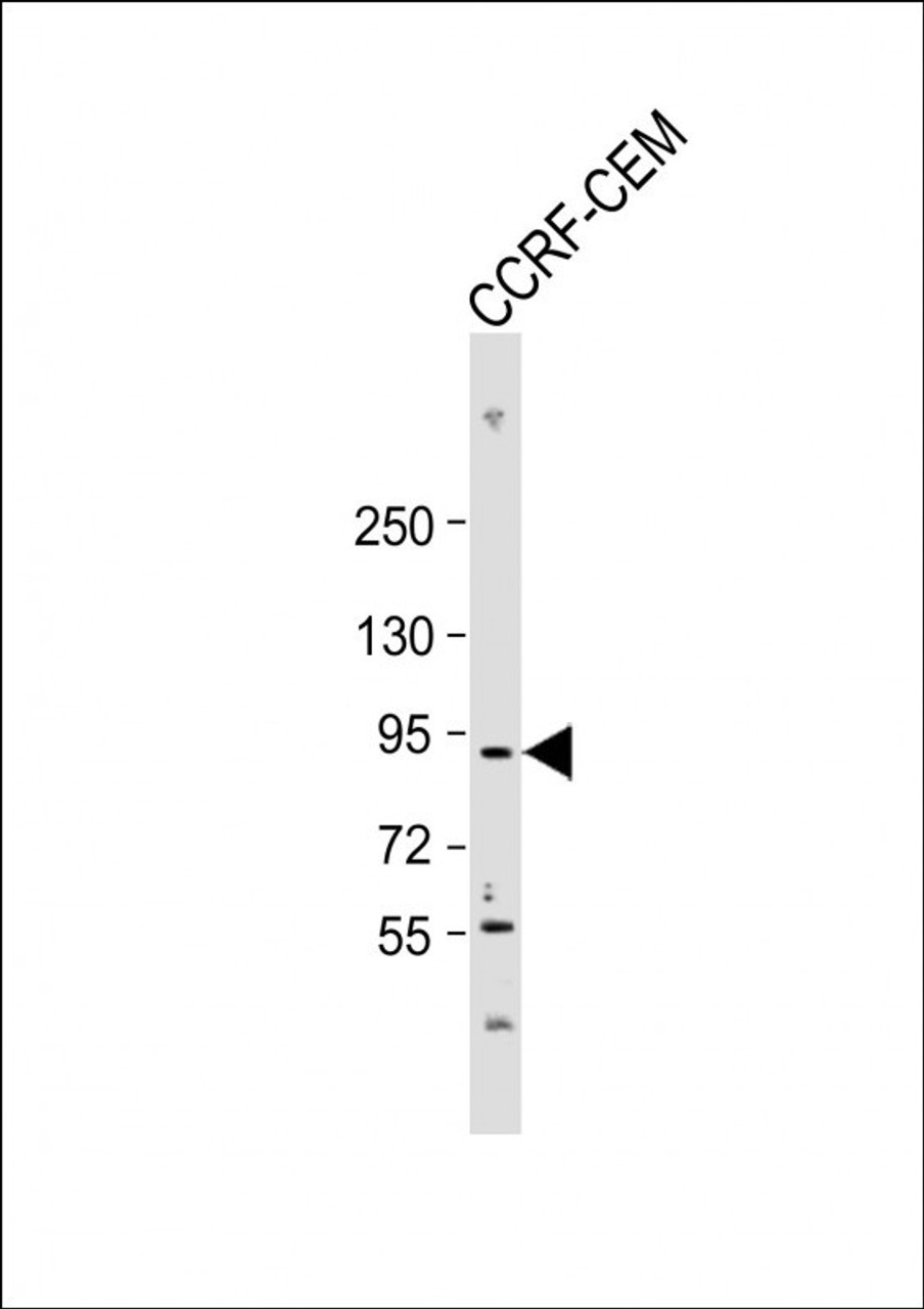 Western Blot at 1:2000 dilution + CCRF-CEM whole cell lysate Lysates/proteins at 20 ug per lane.