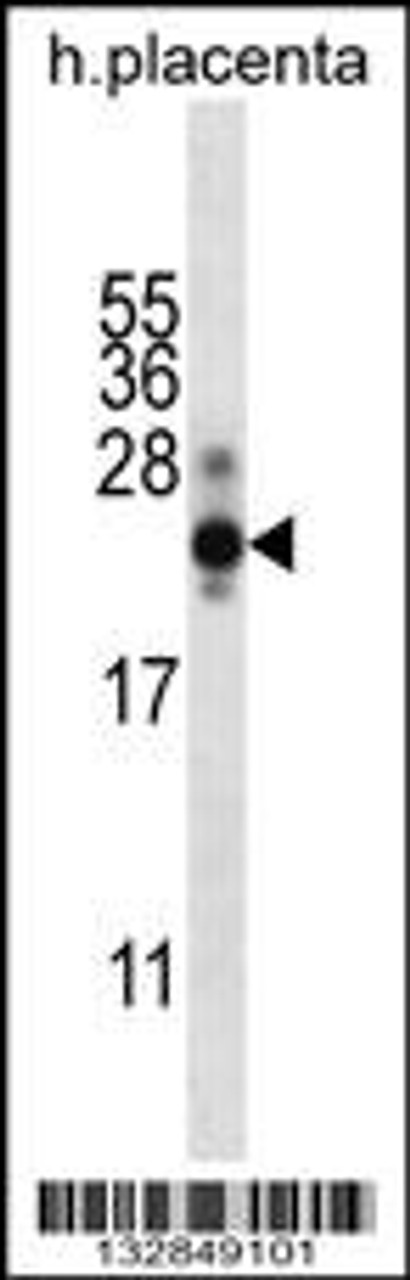 Western blot analysis in human placenta tissue lysates (35ug/lane) .This demonstrates the detected the CGB/HCG-Beta protein (arrow) .