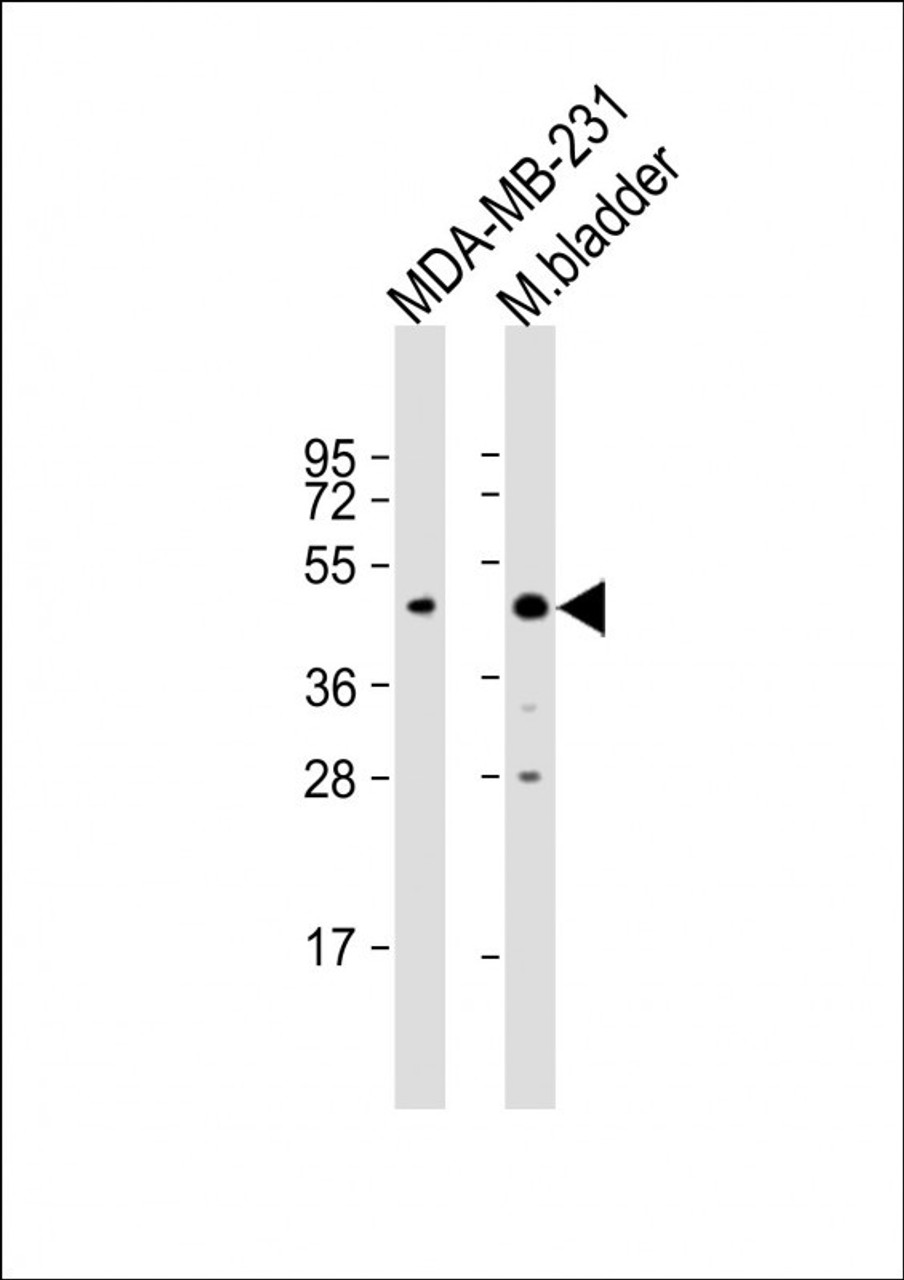 Western Blot at 1:2000 dilution Lane 1: MDA-MB-231 whole cell lysate Lane 2: mouse bladder lysate Lysates/proteins at 20 ug per lane.