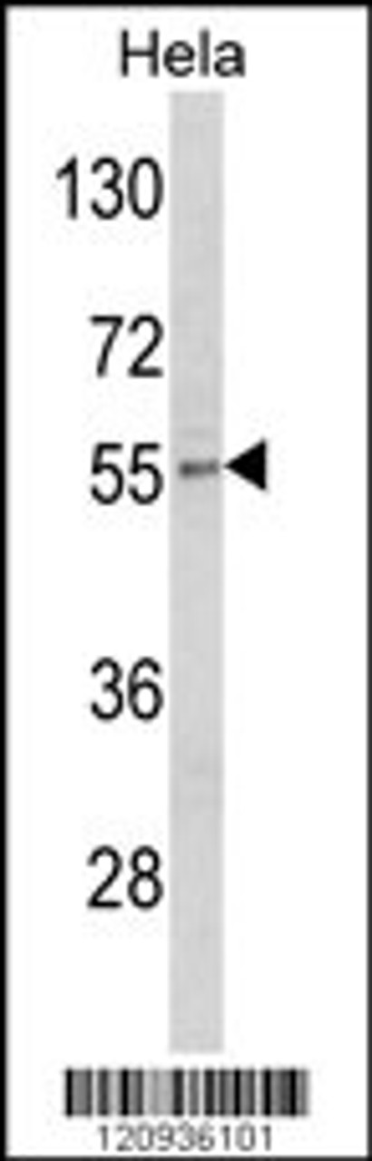 Western blot analysis of DFNA5 Antibody in Hela cell line lysates (35ug/lane)