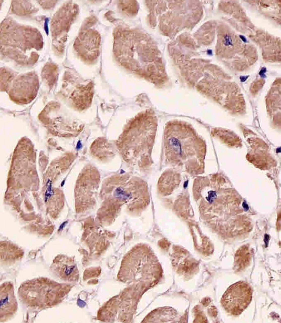 Antibody staining SPHK1 in human heart tissue sections by Immunohistochemistry (IHC-P - paraformaldehyde-fixed, paraffin-embedded sections) .