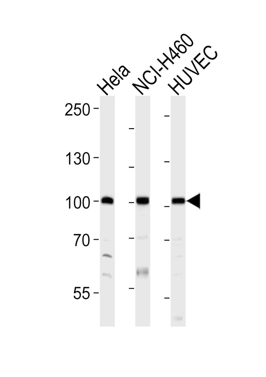 Western blot analysis of lysates from Hela, NCI-H460, HUVEC cell line (from left to right) , using EPHA4 Antibody (R890) at 1:1000 at each lane.