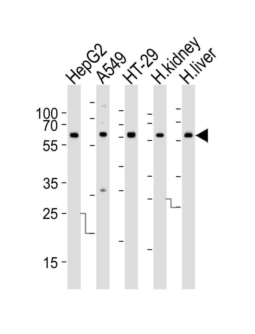 Western blot analysis of lysates from HepG2, A549, HT-29 cell line, human kidney and liver tissue lysate (from left to right) , using CYP3A4 Antibody at 1:1000 at each lane.