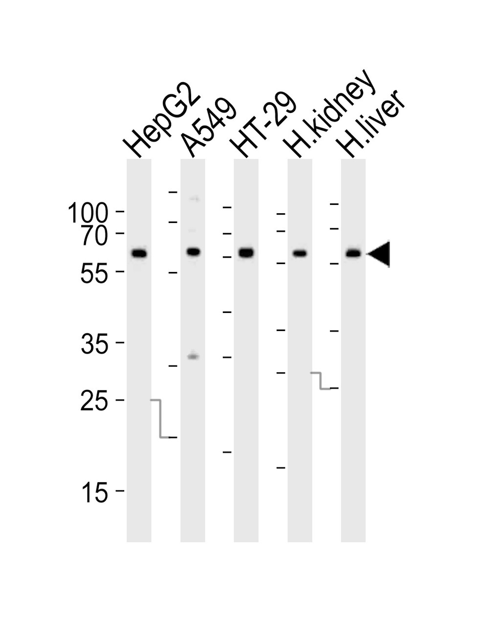 Western blot analysis of lysates from HepG2, A549, HT-29 cell line, human kidney and liver tissue lysate (from left to right) , using CYP3A4 Antibody at 1:1000 at each lane.