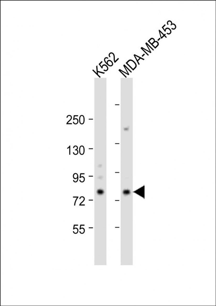 Western Blot at 1:2000 dilution Lane 1: K562 whole cell lysate Lane 2: MDA-MB-453 whole cell lysate Lysates/proteins at 20 ug per lane.