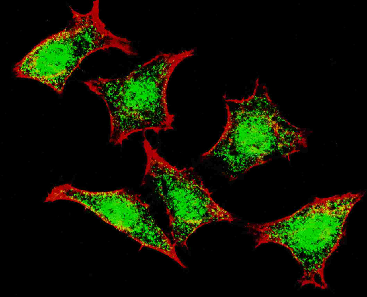 Fluorescent confocal image of HeLa cells stained with Natriuretic Peptide Receptor C antibody. HeLa cells were fixed with 4% PFA (20 min) , permeabilized with Triton X-100 (0.2%, 30 min) . Cells were then incubated with Natriuretic Peptide Receptor C primary antibody (1:200, 2 h at room temperature) . For secondary antibody, Alexa Fluor 488 conjugated donkey anti-rabbit antibody (green) was used (1:1000, 1h) . Nuclei were counterstained with Hoechst 33342 (blue) (10 ug/ml, 5 min) . Note the highly specific localization of the Natriuretic Peptide Receptor C mainly to the mainly to the nucleus.