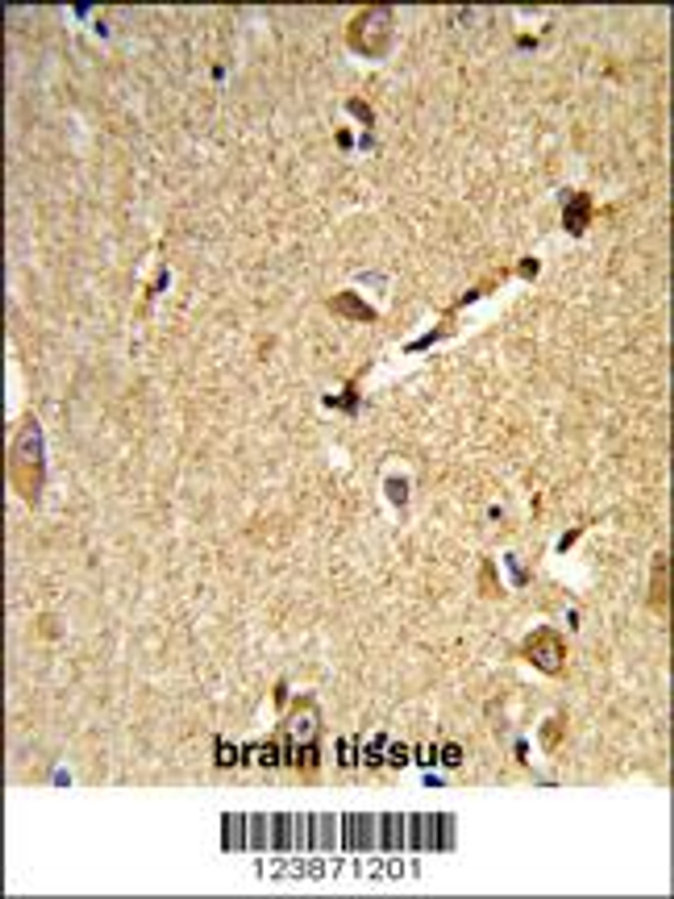 Formalin-fixed and paraffin-embedded human brain tissue reacted with DLL3 Antibody, which was peroxidase-conjugated to the secondary antibody, followed by DAB staining.