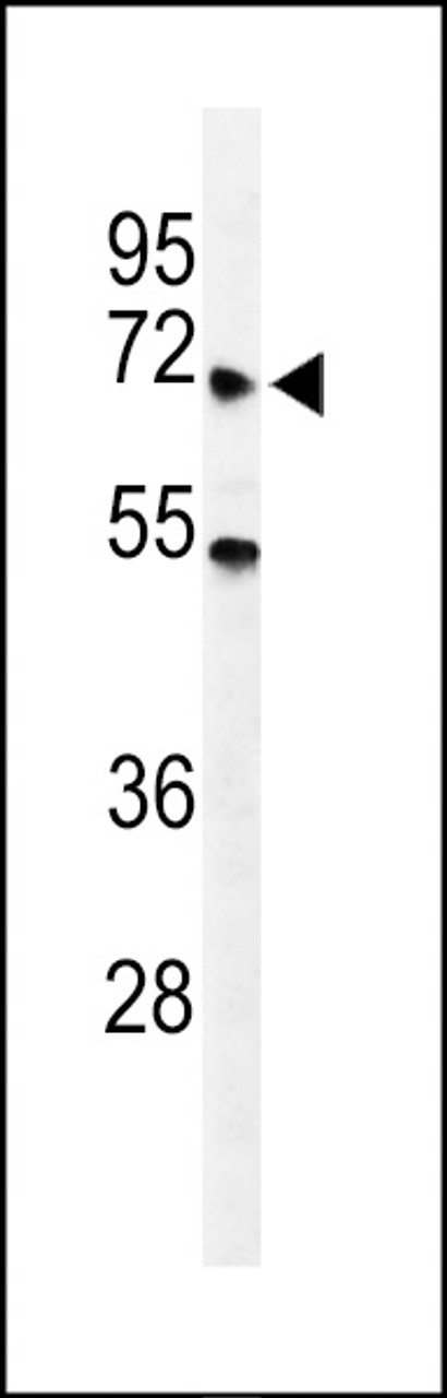 Western blot analysis of YTHD3 Antibody in A549 cell line lysates (35ug/lane)