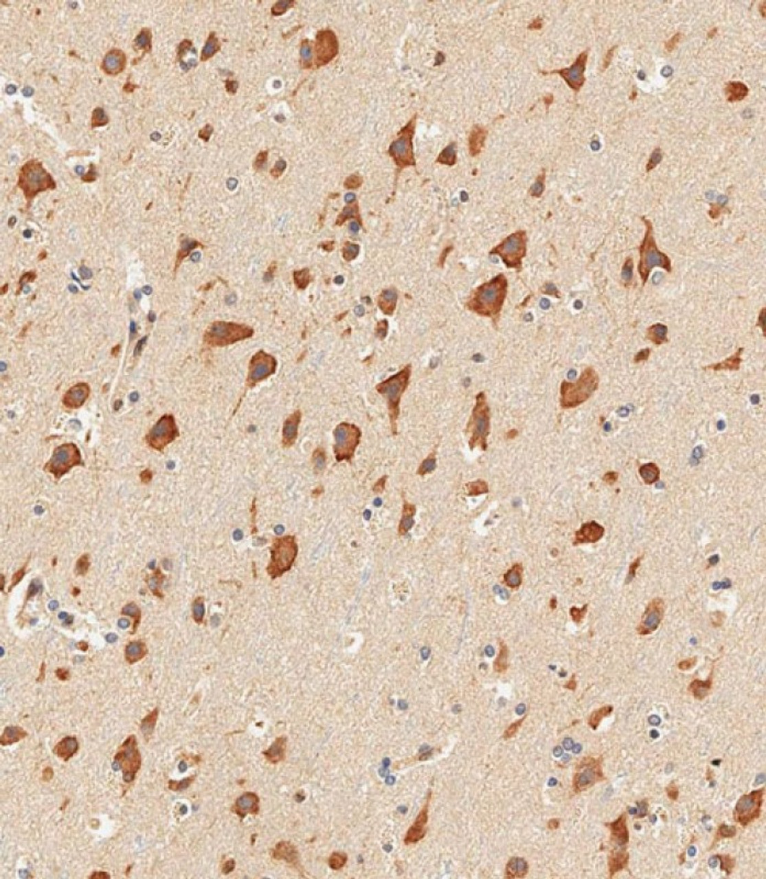 Immunohistochemical analysis of paraffin-embedded human brain tissue using 64-232 performed on the Leica® BOND RXm. Samples were incubated with primary antibody (1/500) for 1 hours at room temperature. A undiluted biotinylated CRF Anti-Polyvalent HRP Polymer antibody was used as the secondary antibody.