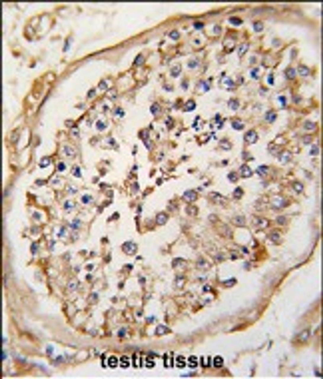Formalin-fixed and paraffin-embedded human testis tissue reacted with NARP (Nptx2) Antibody (Center) , which was peroxidase-conjugated to the secondary antibody, followed by DAB staining. This data demonstrates the use of this antibody for immunohistochemistry; clinical relevance has not been evaluated.