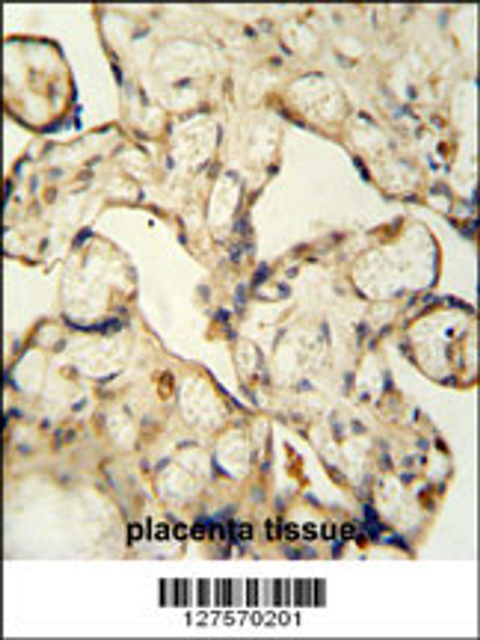 LCA5L antibody immunohistochemistry analysis in formalin fixed and paraffin embedded human placenta tissue followed by peroxidase conjugation of the secondary antibody and DAB staining.