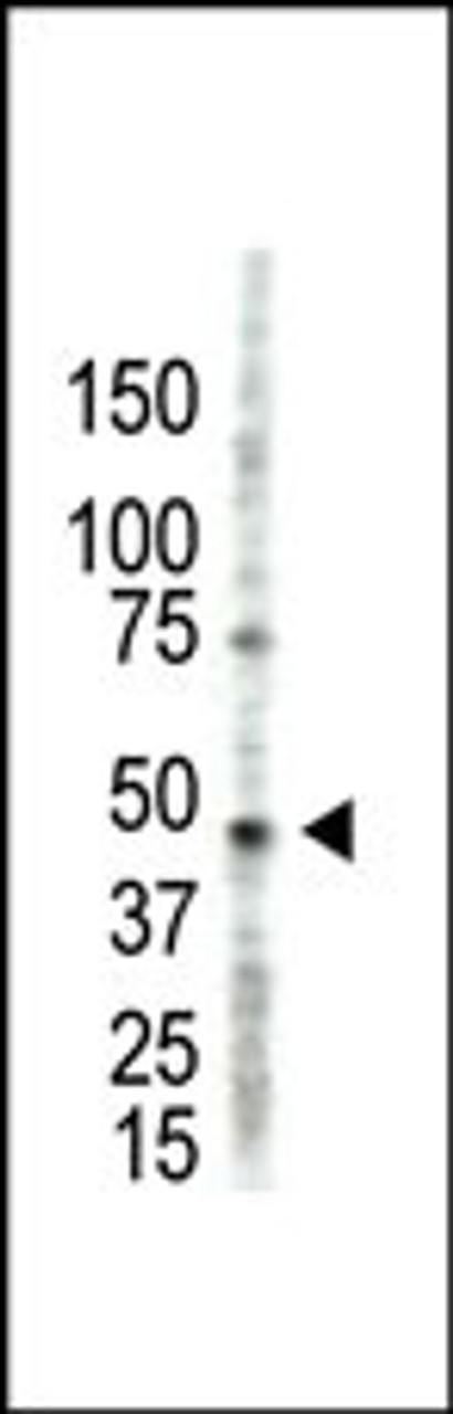 Antibody is used in Western blot to detect PRMT2 in HL60 cell lysate.