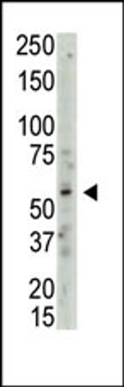 Western blot analysis of anti-PRMT3 Pab in whole HL60 cell lysate: PRMT3 was detected using purified Pab (Lane B) but not pre-immune serum (lane A) .