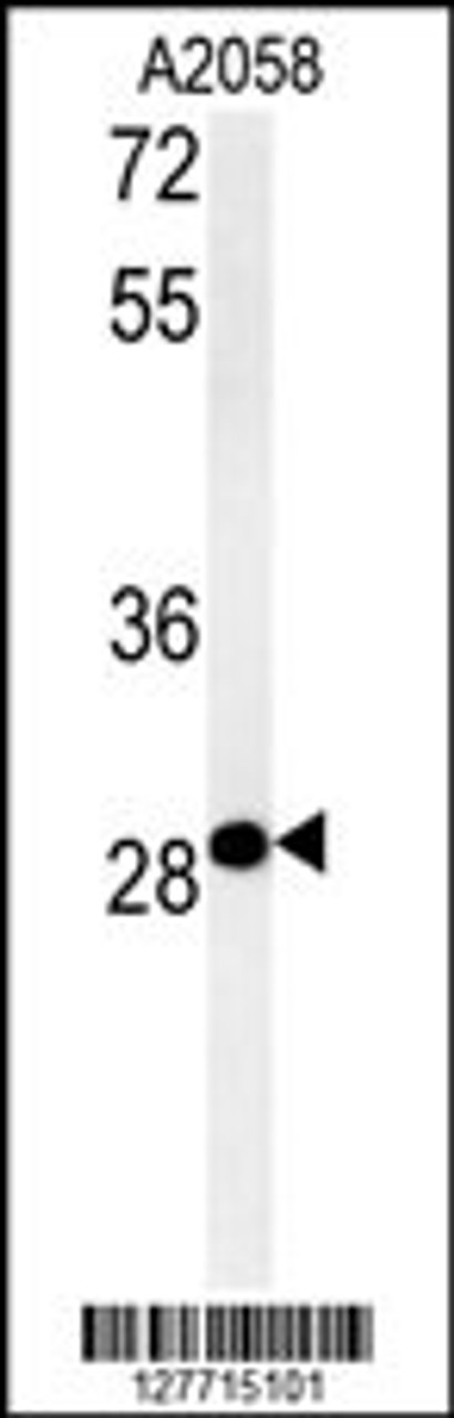 Western blot analysis in A2058 cell line lysates (35ug/lane) .