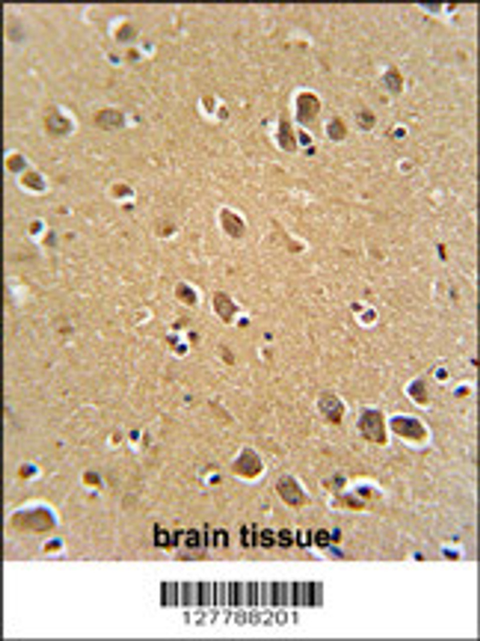 RFT1 antibody immunohistochemistry analysis in formalin fixed and paraffin embedded human brain tissue followed by peroxidase conjugation of the secondary antibody and DAB staining.