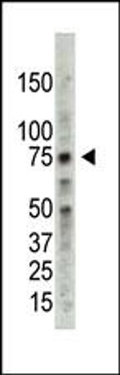 Antibody is used in Western blot to detect PRMT5 in HL60 cell lysate.