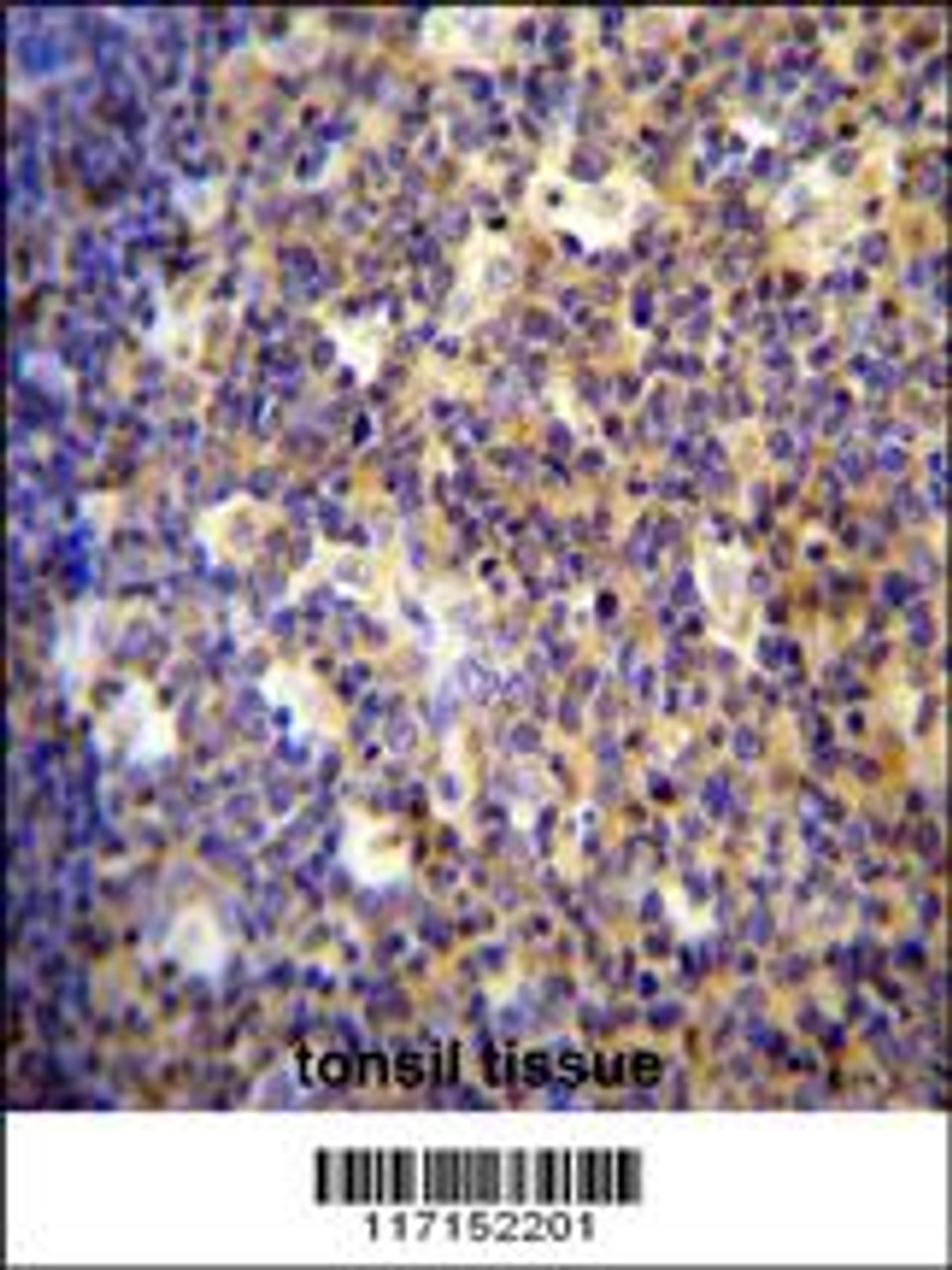 ALOX12B antibody immunohistochemistry analysis in formalin fixed and paraffin embedded human tonsil tissue followed by peroxidase conjugation of the secondary antibody and DAB staining.