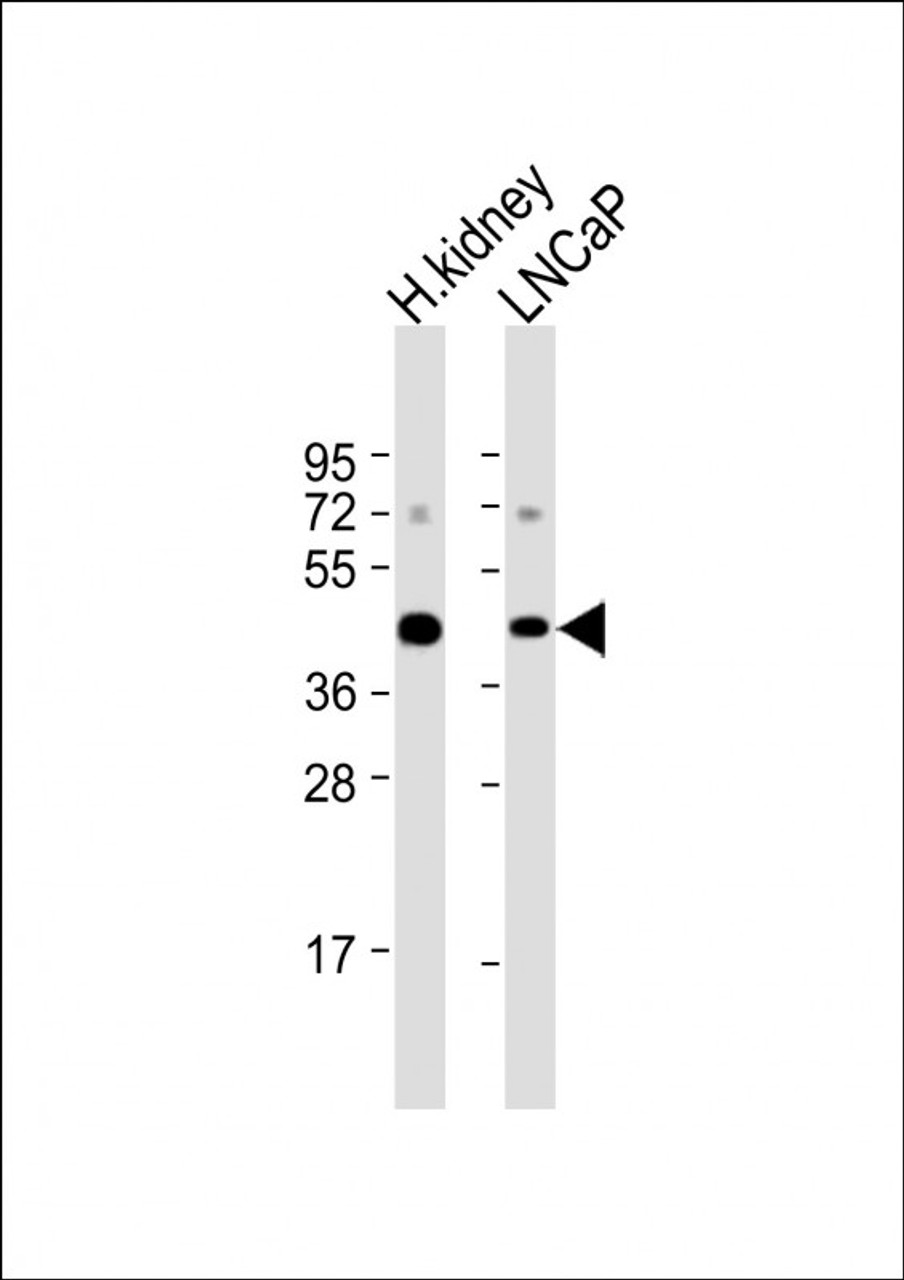 Western Blot at 1:1000 dilution Lane 1: human kidney lysate Lane 2: LNCaP whole cell lysate Lysates/proteins at 20 ug per lane.