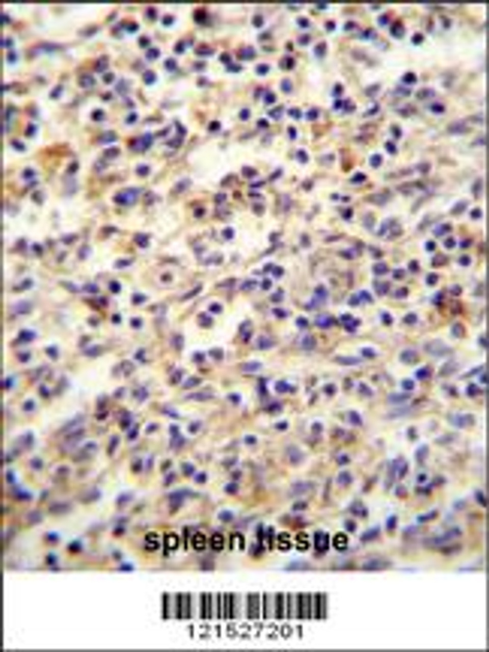 IGF2BP2 antibody immunohistochemistry analysis in formalin fixed and paraffin embedded human spleen tissue followed by peroxidase conjugation of the secondary antibody and DAB staining.