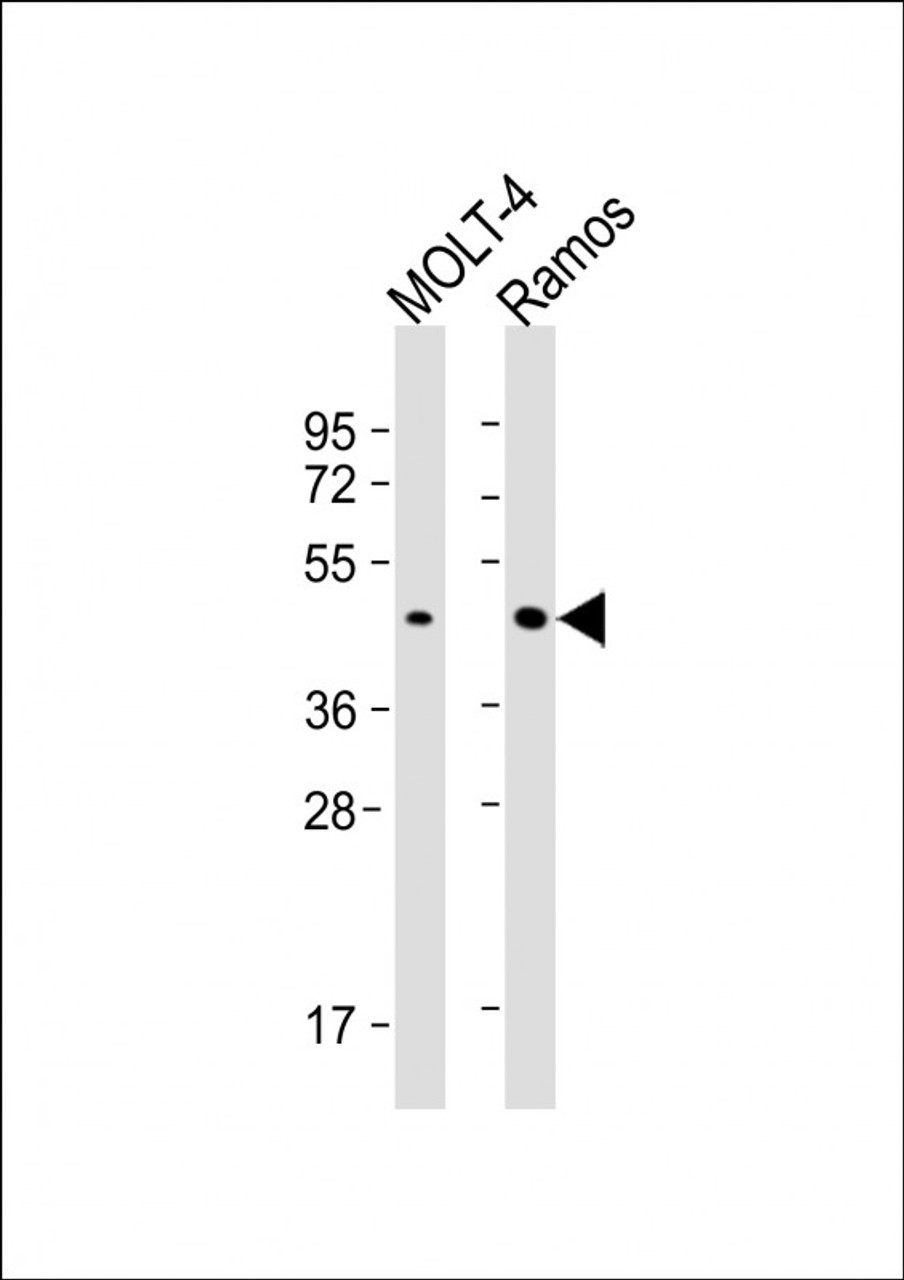 Western Blot at 1:1000 dilution Lane 1: MOLT-4 whole cell lysate Lane 2: Ramos whole cell lysate Lysates/proteins at 20 ug per lane.