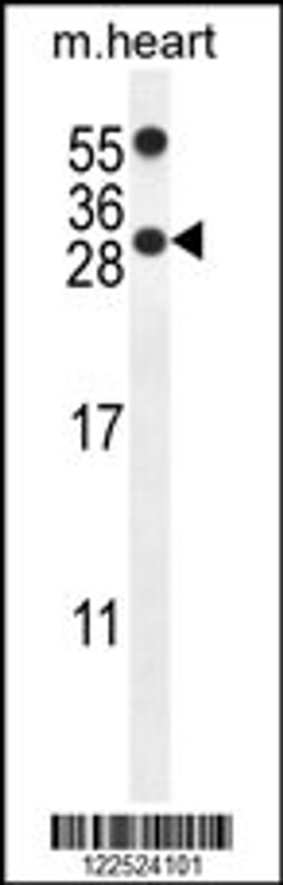 Western blot analysis in mouse heart tissue lysates (35ug/lane) .