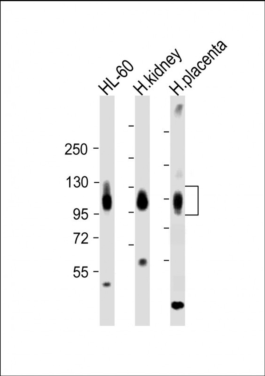 Western Blot at 1:2000 dilution Lane 1: HL-60 whole cell lysate Lane 2: human kidney lysate Lane 3: human placenta lysate Lysates/proteins at 20 ug per lane.