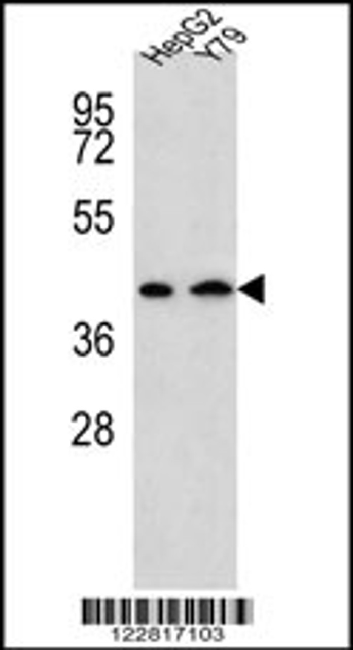 Western blot analysis in HepG2, Y79 cell line lysates (35ug/lane) .