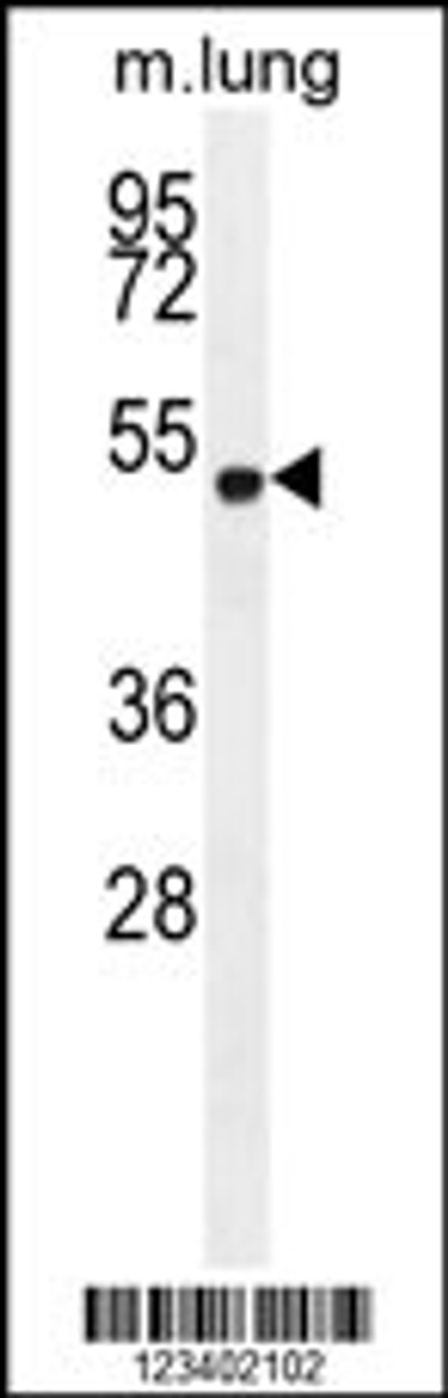 Western blot analysis in mouse lung tissue lysates (35ug/lane) .This demonstrates the Edetected the EKI2 protein (arrow) .