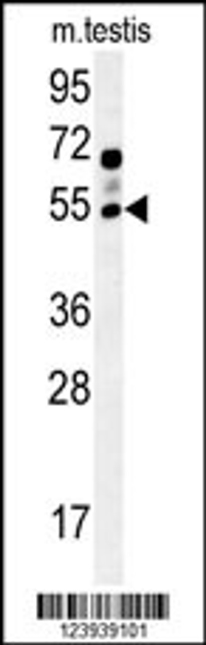 Western blot analysis in mouse testis tissue lysates (15ug/lane) .This demonstrates the detected GABRG2 protein (arrow) .