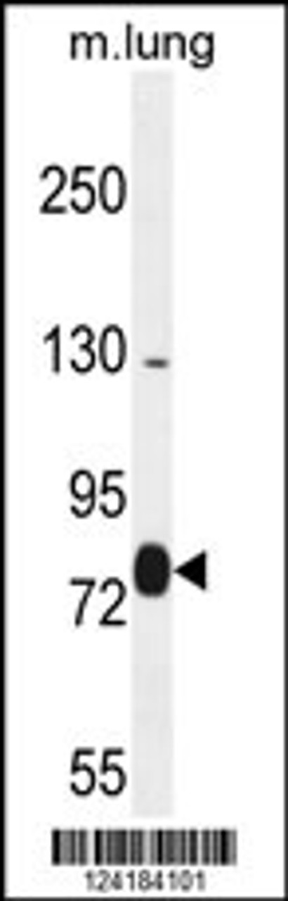 Western blot analysis in mouse lung tissue lysates (35ug/lane) .