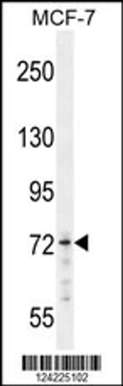 Western blot analysis in MCF-7 cell line lysates (35ug/lane) .This demonstrates thdetected the MED25 protein (arrow) .