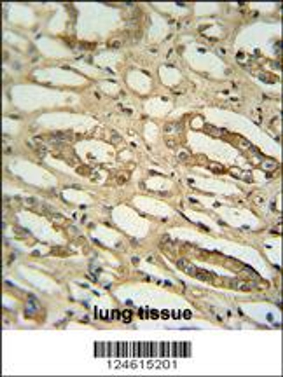 GGTLC2 antibody immunohistochemistry analysis in formalin fixed and paraffin embedded human lung tissue followed by peroxidase conjugation of the secondary antibody and DAB staining.