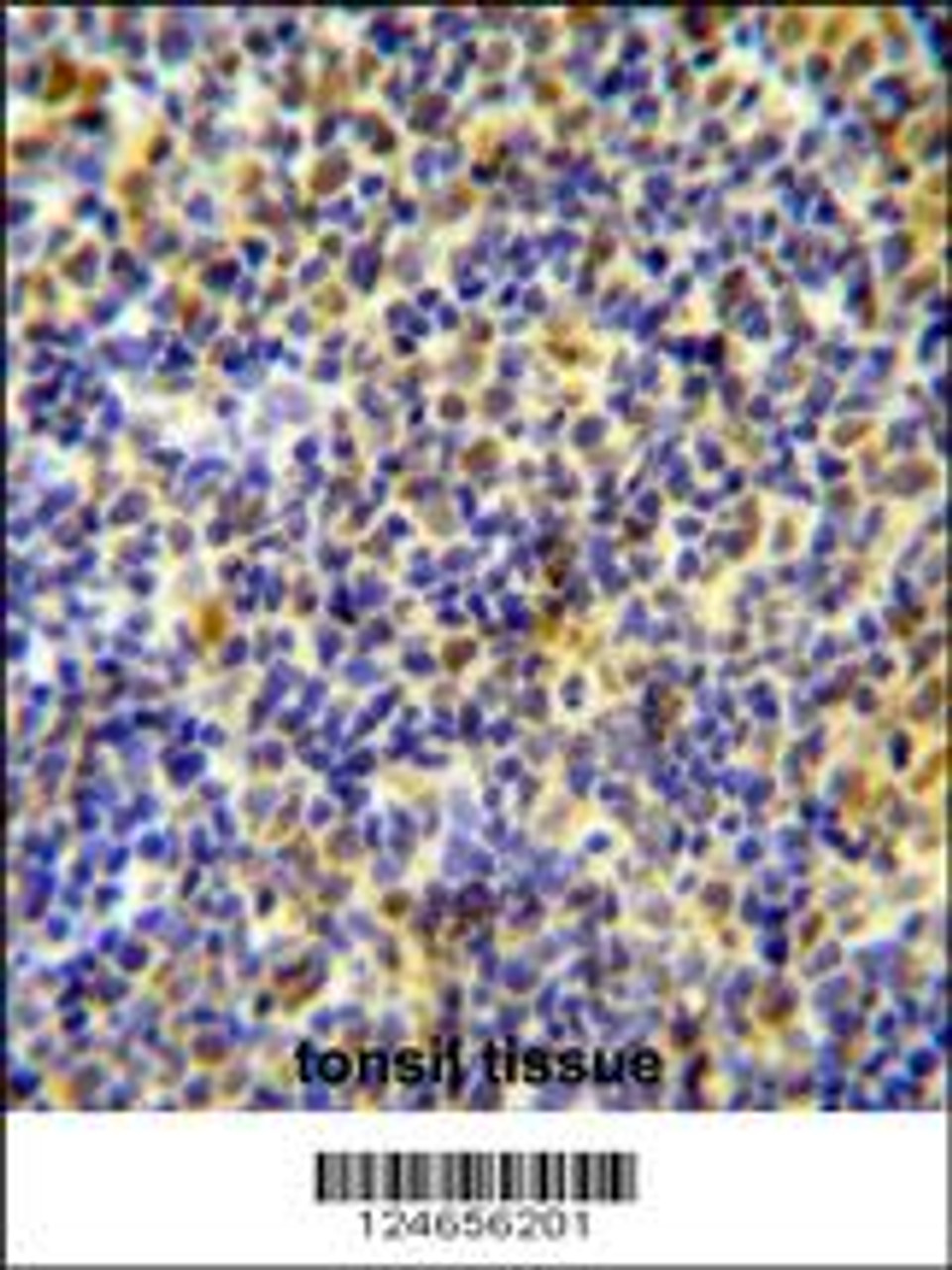 IKZF1 Antibody immunohistochemistry analysis in formalin fixed and paraffin embedded human tonsil tissue followed by peroxidase conjugation of the secondary antibody and DAB staining.