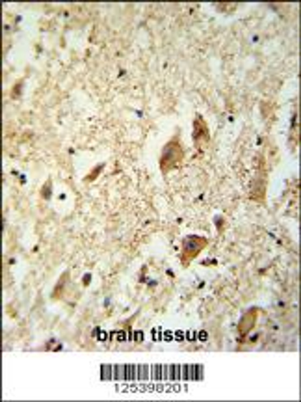 KATL1 antibody immunohistochemistry analysis in formalin fixed and paraffin embedded human brain tissue followed by peroxidase conjugation of the secondary antibody and DAB staining.