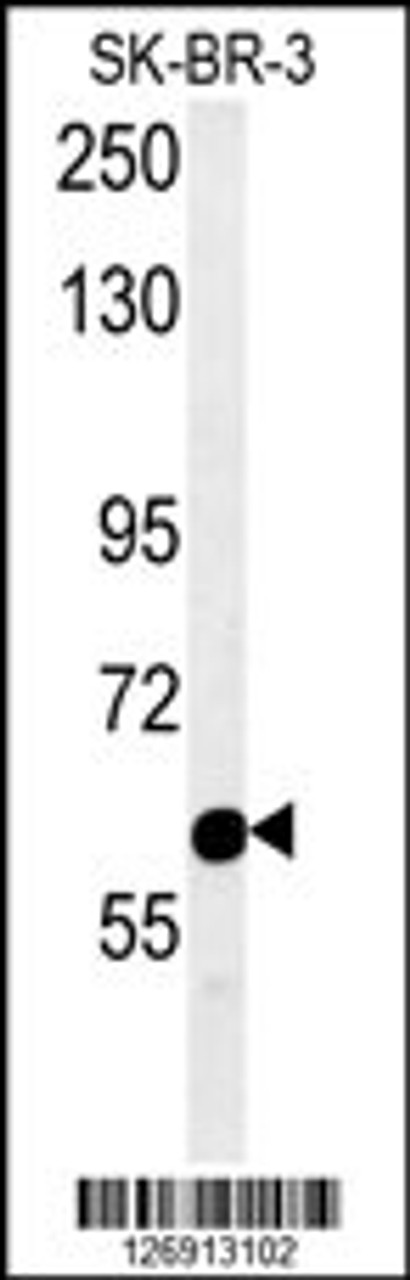 Western blot analysis in SK-BR-3 cell line lysates (15ug/lane) .This demonstrates the detected RADIL protein (arrow) .