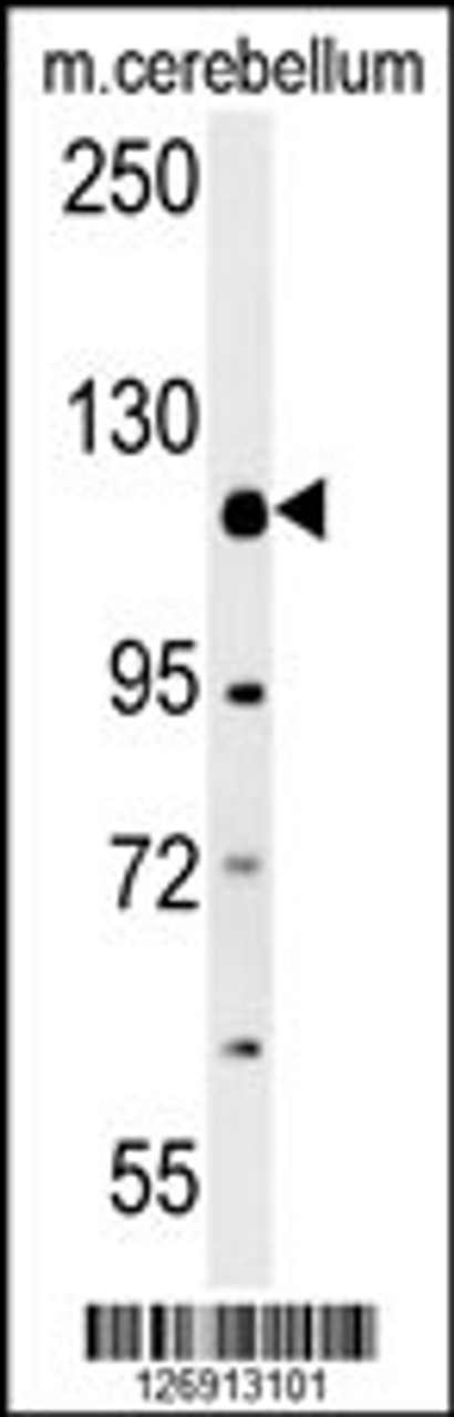 Western blot analysis in mouse cerebellum tissue lysates (15ug/lane) .This demonstrates the detected RADIL protein (arrow) .