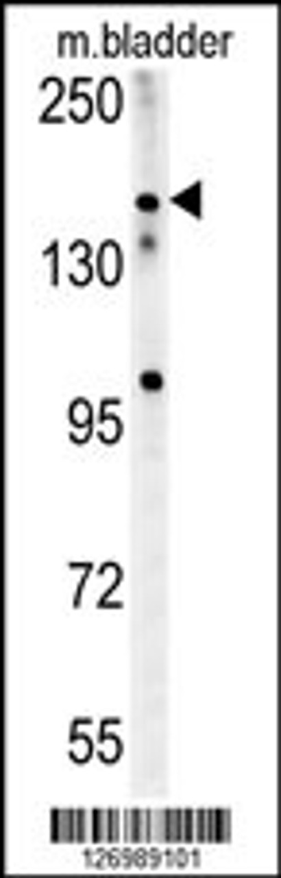 Western blot analysis in mouse bladder tissue lysates (15ug/lane) .This demonstrates the detected CASZ1 protein (arrow) .