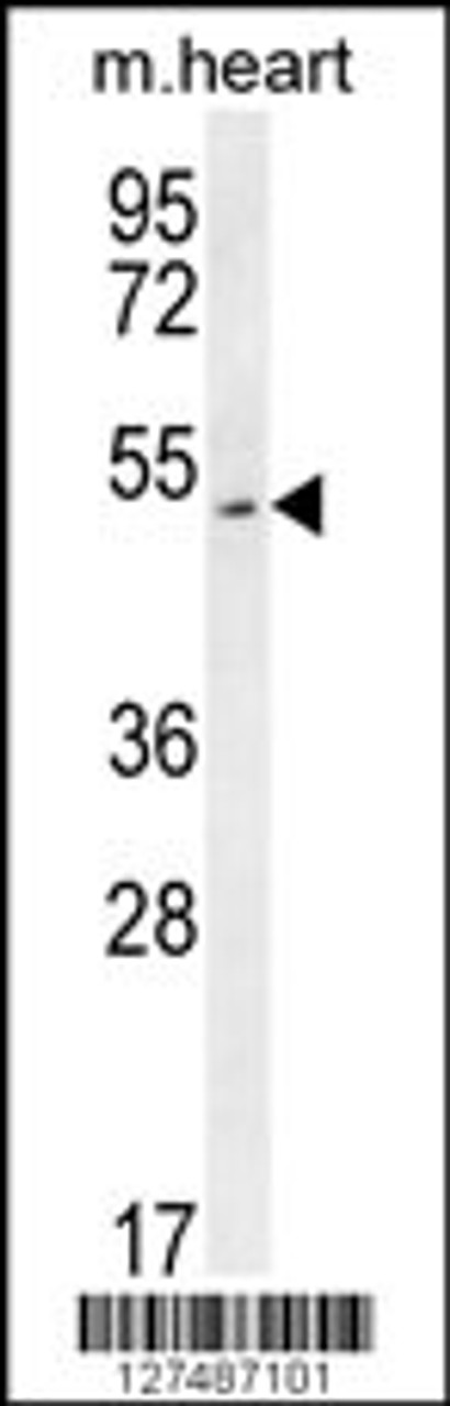 Western blot analysis in mouse heart tissue lysates (35ug/lane) .