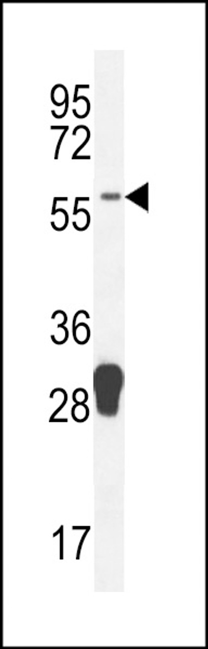 Western blot analysis in mouse spleen tissue lysates (35ug/lane) .