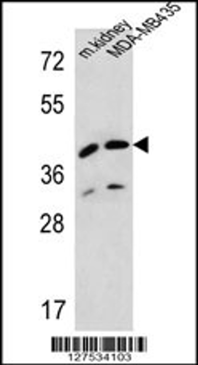 Western blot analysis in MDA-MB435 cell line and mouse kidney tissue lysates (35ug/lane) .