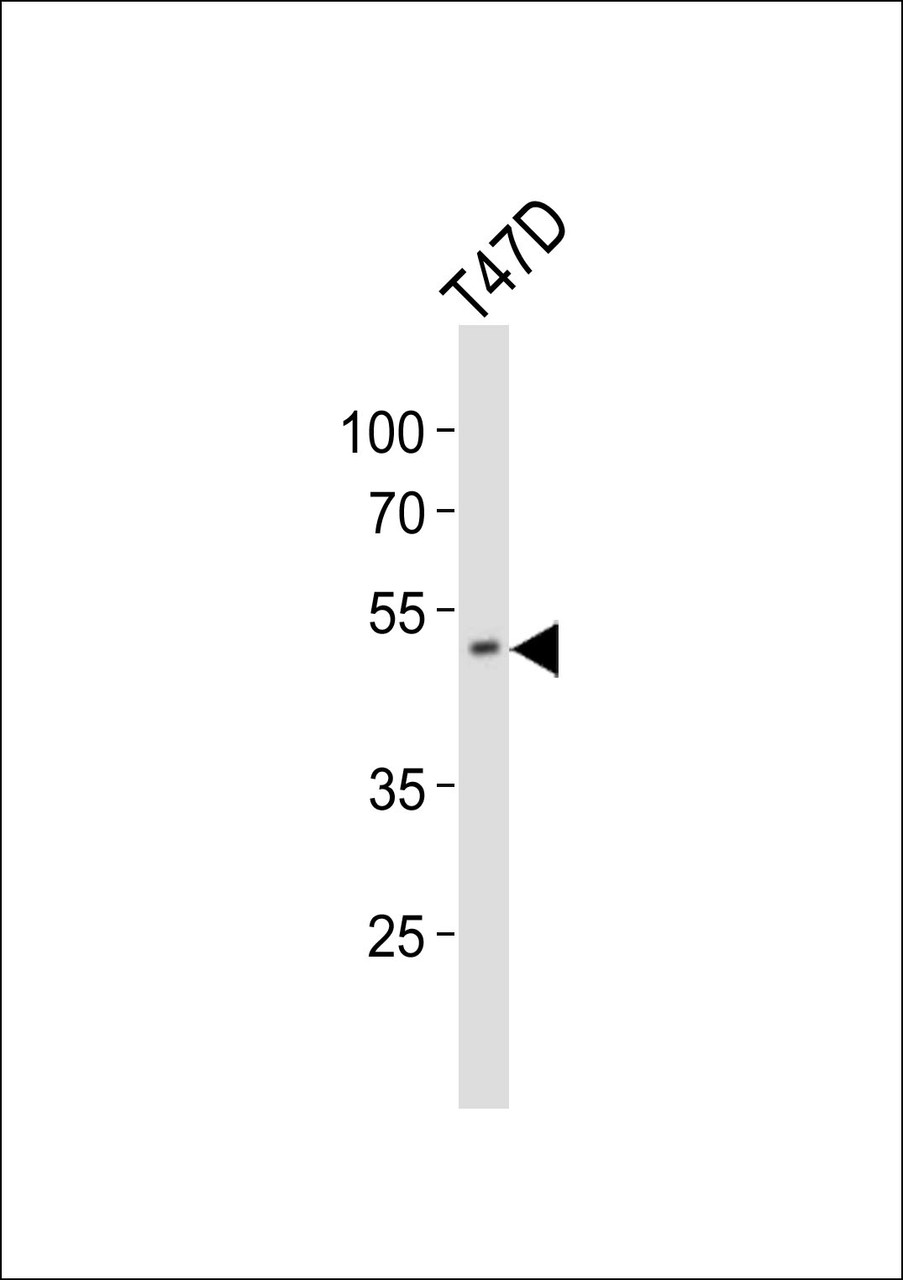 Western blot analysis of lysate from T47D cell line, using HOXA10 Antibody at 1:1000.