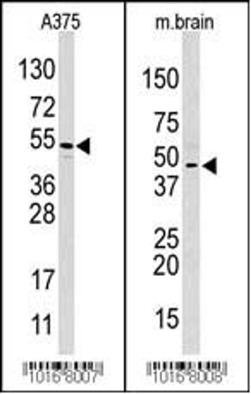 Western blot analysis of anti-HIF1AN Pab in A375 and mouse brain cell line lysate