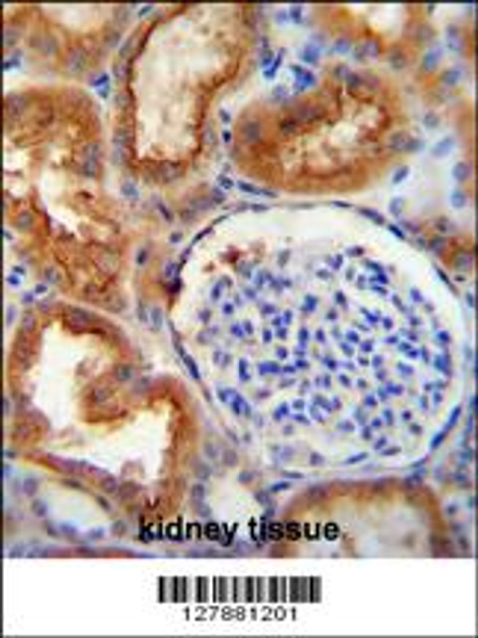 SLC5A12 antibody immunohistochemistry analysis in formalin fixed and paraffin embedded human kidney tissue followed by peroxidase conjugation of the secondary antibody and DAB staining.
