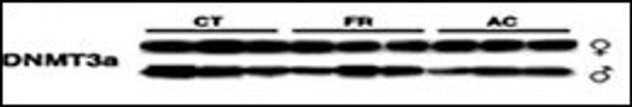 Lysates from mice thymus tissue after radiation were subjected to WB using antibody against DNMT3a. CT, control animals; FR, animals subjected to fractionated exposure; AC, acutely exposed animals. All sample loading was normalized to protein content. Representative Western blots from three independent experiments are shown; each lane represents a protein extract of a thymus of one animal. (Mol. Cancer Res. 2005 Oct 01;3 (10) :553-561)