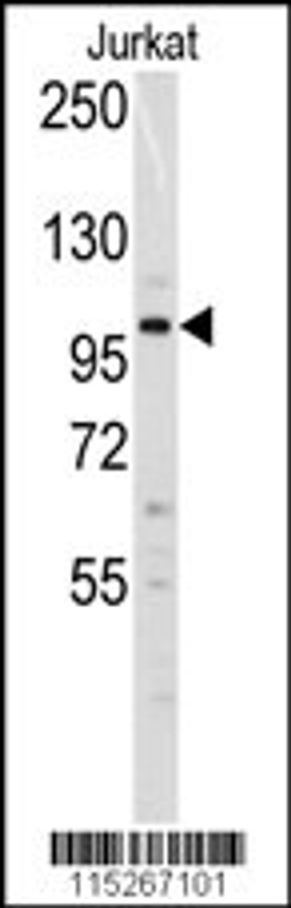 Western blot analysis of anti-Dnmt3a Antibody (N-term R46) in Jurkat cell line lysates (35ug/lane) .