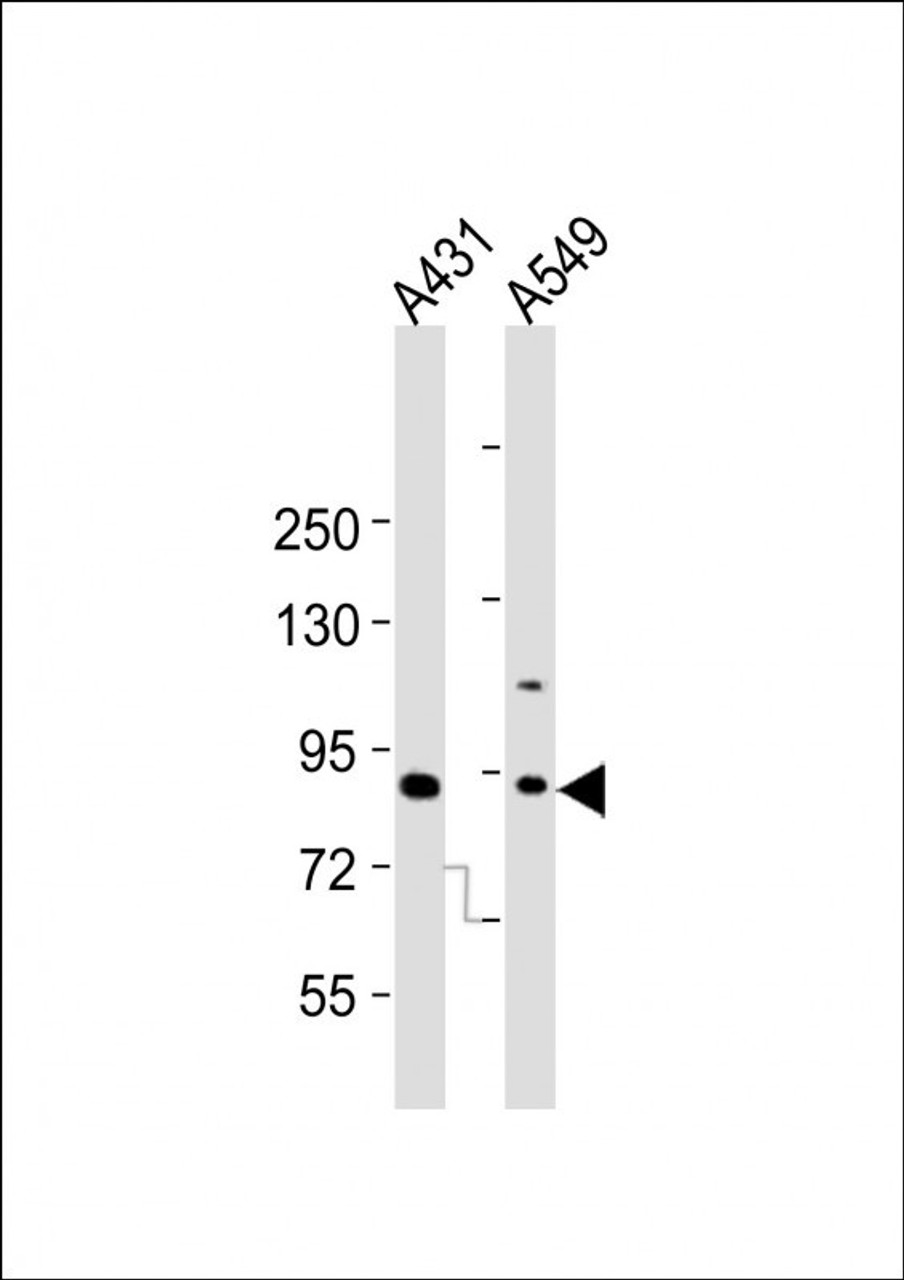 Western Blot at 1:2000 dilution Lane 1: A431 whole cell lysates Lane 2: A549 whole cell lysates Lysates/proteins at 20 ug per lane.