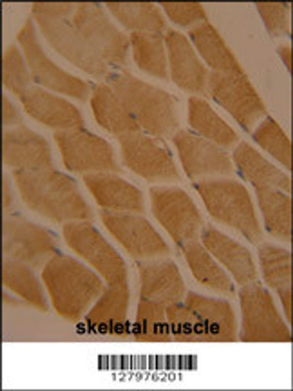 LMOD2 antibody immunohistochemistry analysis in formalin fixed and paraffin embedded human skeletal muscle followed by peroxidase conjugation of the secondary antibody and DAB staining.